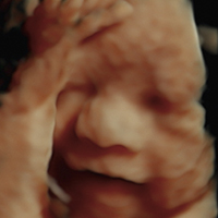 Ultrasonido - Medicina Fetal Campeche