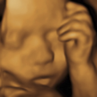 Ultrasonido - Medicina Fetal Campeche